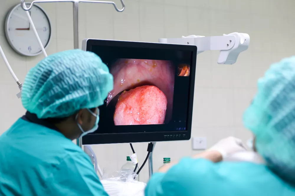 Upper GI Endoscopy